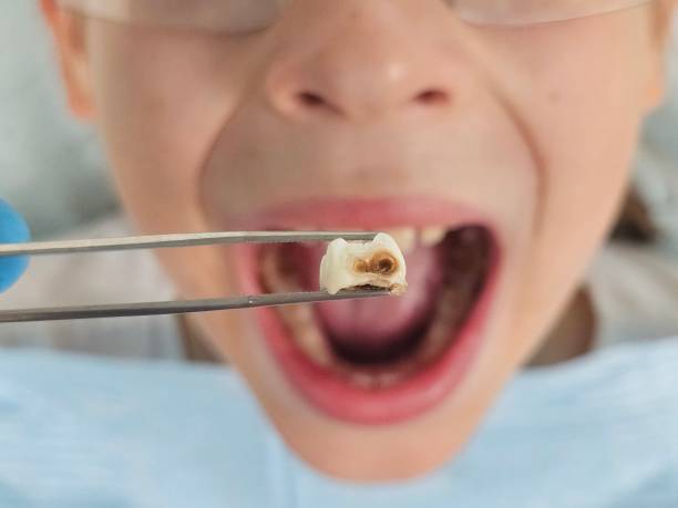 Best Emergency Gum Treatment in Bolindale, OH