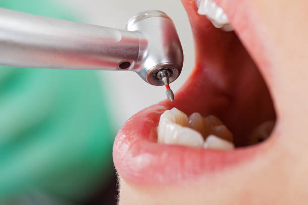 Best Emergency Denture Repair in Bolindale, OH